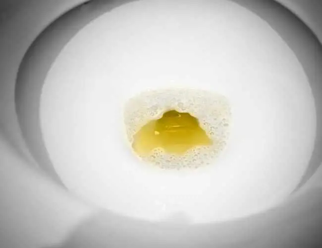 Why is my toilet water yellow